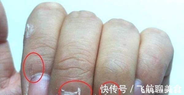 不良习惯|没有妇科疾病的女人,手上有4个特征,你若占1个,子宫很健康