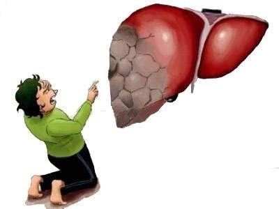 不良习惯|肝不好,嘴先知!无论男女,嘴上有3个“预兆”,肝硬化一触即发