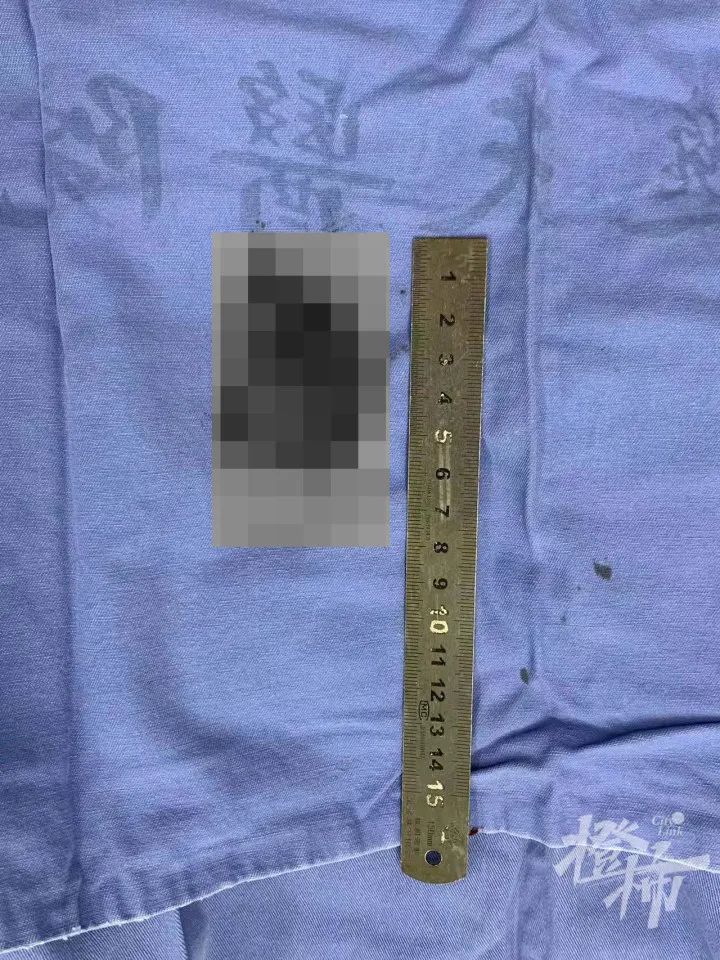 甲状旁腺|这个存在感低的体检项目,忽视可能致命!