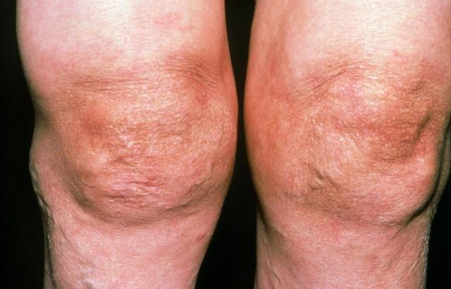 生姜|一道食疗，每周吃一次，保护关节，强筋骨，老了腿脚还利索！