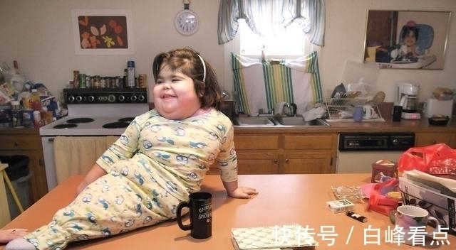 希洛|现实美人鱼女孩:没有双腿长了“人鱼尾”,却从未停止摇摆尾巴