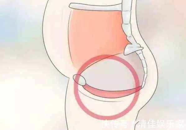 夫妻生活|女性顺产后一定比剖腹产松吗难怪那么多人宁愿“挨一刀”也不顺