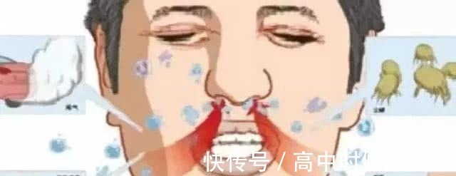 辛夷|鼻炎发作很难受一把小葱, 不出半月, 鼻涕消了, 鼻炎也见好!