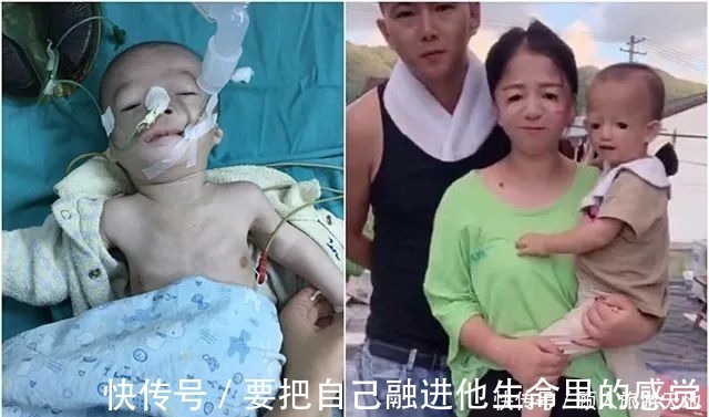 孩子|“鸟脸”妈妈执意生二胎,孩子不幸被遗传,一时的冲动毁孩子一生