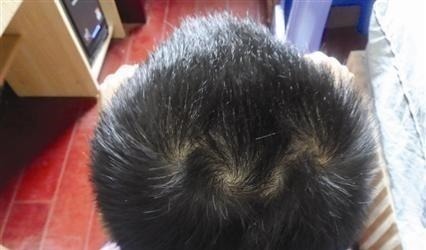 父母|为什么有的孩子头上有“2个旋”代表什么意思,父母要知道!