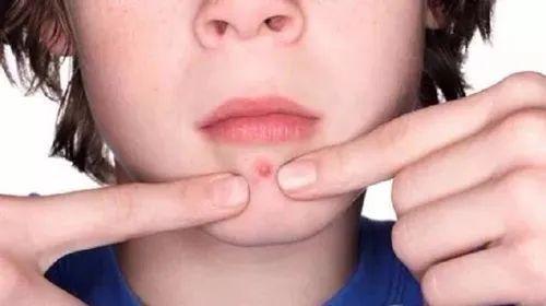 金匮要略|小寒之后，少吃什么，多吃什么，一次性全都告诉你！一冬都健康！