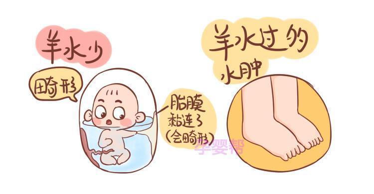 危险|羊水浑浊胎儿容易“缺氧窒息”，孕晚期注意4点，避免危险发生