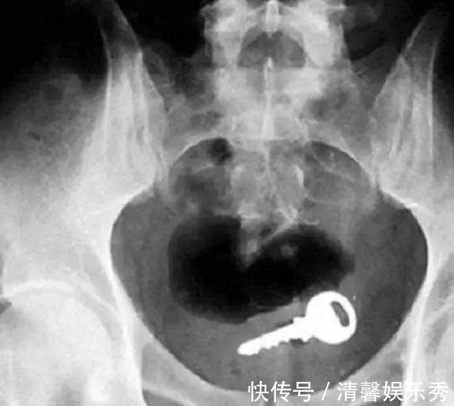 孩子|奶奶送孙女祖传银手镯，手镯一天比一天亮，医生怒斥：赶紧摘掉