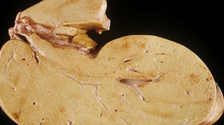 此种食物是肝脏“清道夫”,常吃可以养血滋肝,爱吃的人都有福气