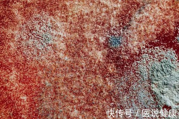 肝脏|肝部有囊肿,或与这5个因素有关,要小心预防,不忽视