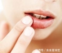 蒸梨|嘴唇老爱干裂起皮？聪明人这样做，可轻松解决，不用唇膏也水嫩