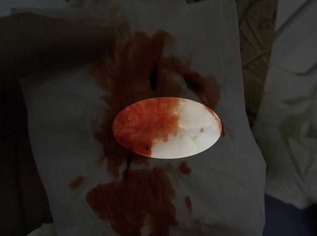 见红|超预产期三天还不生宝宝在出生之前,会给妈妈三个信号