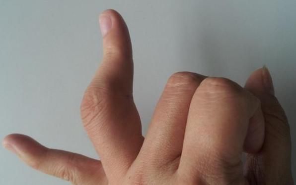 老中医：1个鸡蛋+玉米，2周尿酸降到280，痛风也消失了！