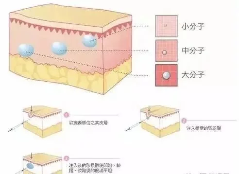 微整