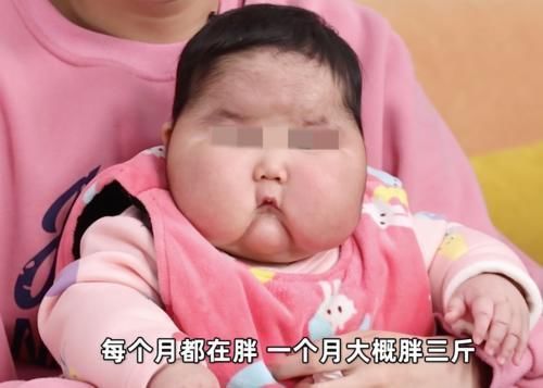 大v|“大头娃娃”再次出现，额头长满汗毛，这次是“毒护肤霜”惹的祸