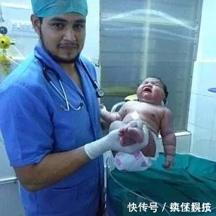 新生儿|19岁女孩生下13.6斤巨婴 原因让人瞠目结舌