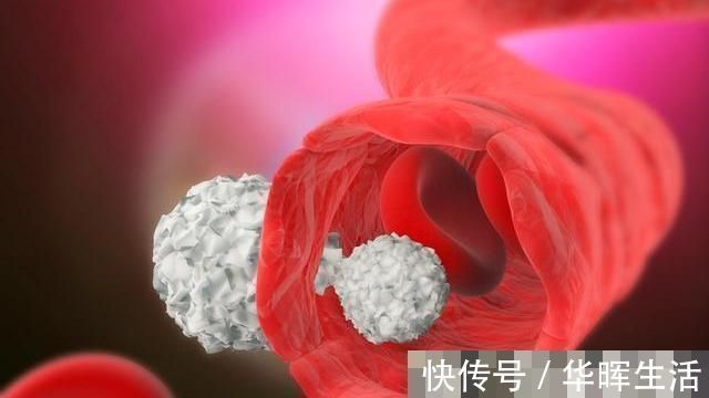 胆固醇|高血脂的“劲敌”被找到，并非山楂，若你爱吃，血脂或乖乖降下来