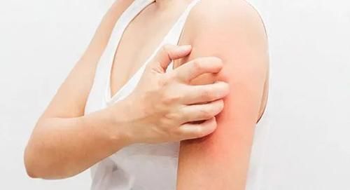 无知|皮炎伴随在我们的生活之中 对“敌人”的无知终会害了自己