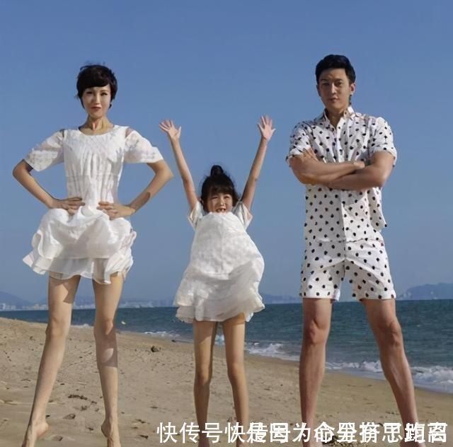 孩子|孩子腿部有2个特点,是大长腿的“特征”,长得晚也能后来居上