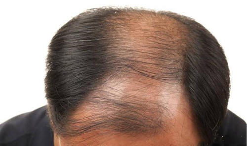 头发隔多久洗一次比较好?多数人可能不知道,看完或许明白