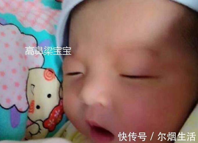 郑嘉颖|宝宝的鼻梁何时“定型”?塌鼻梁的娃想“逆袭”,要满足哪些条件