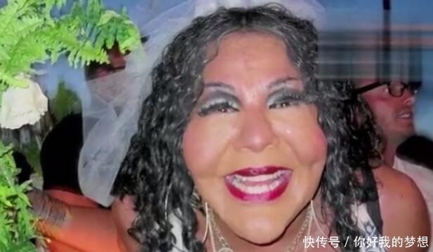 女子花2万元整容,整容失败变成“水泥脸”,看完你还想整容吗?