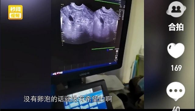 月经不调|37岁女子想怀孕,医生检查后无奈叹息:你要是早一点认识我就好了!