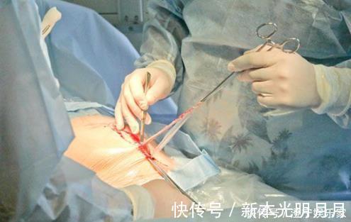 疤痕|剖腹产的5个隐形后遗症,在生二胎时才会现形,准妈妈要谨慎考虑