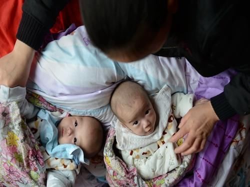 母乳|龙凤胎出生,男孩吃母乳,女孩喝奶粉,对孩子的伤害你可曾想过?