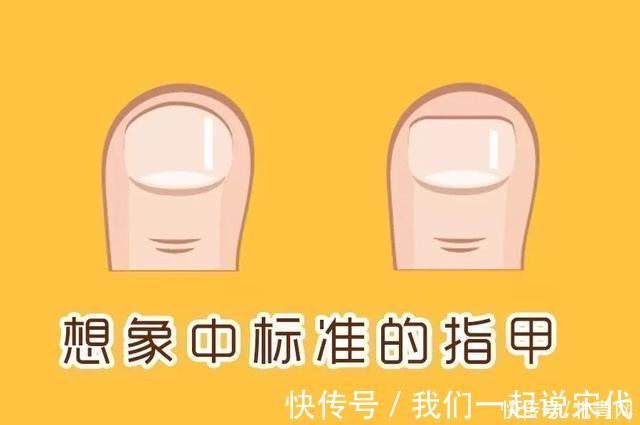 甲周|指甲剪短点才干净？小心，越短越容易患这种病