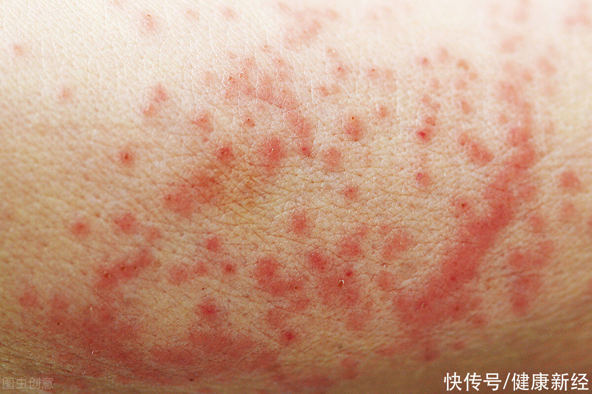 皮肤|皮肤瘙痒到底该怎么办？找到原因是关键，学会这5招即可轻松止痒