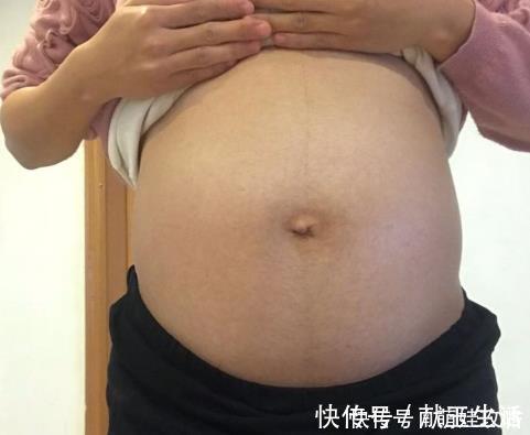 心眼|脐带绕颈一周,可能有这些影响,准妈妈要多留心眼