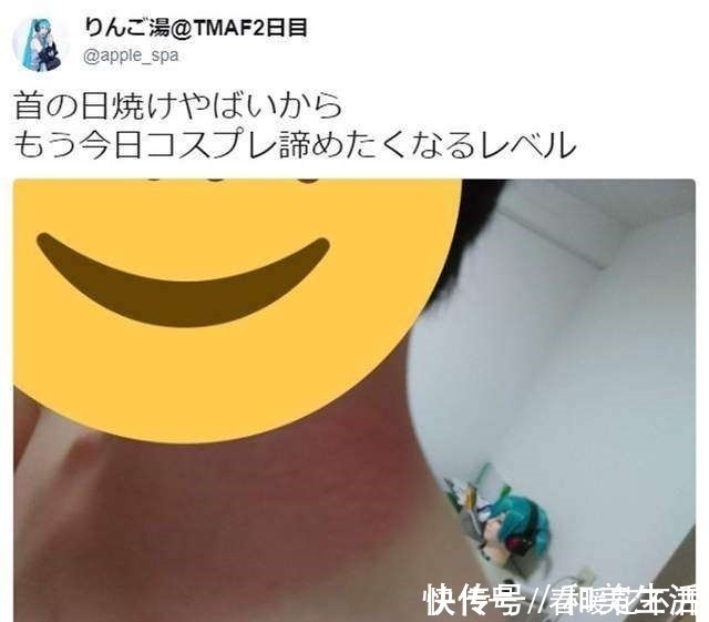 晒伤|日本宅男COS初音被严重晒伤,去年的教训只记得一半的下场