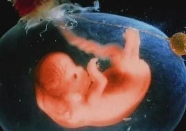 胎儿|准妈妈记住“4不碰”,可以保持羊水“清澈”,让宝宝住得更舒心