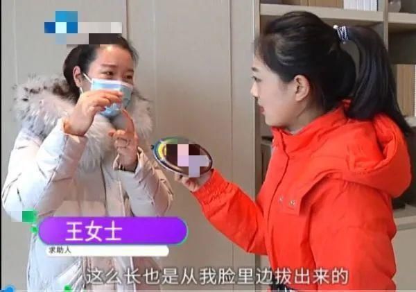 洛阳华美|可怕！女子术后脸上长包，大夫说上火，吃药一个月后，竟从脸上揪出……