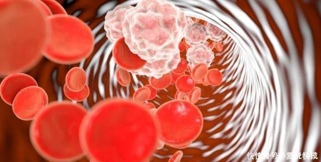 山楂和它是“绝配”,连喝一周,清理血管,还你一个干净身体