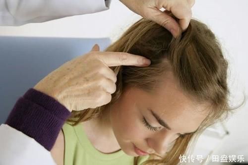 头皮发痒抠出的“白泥”是什么别以为是头皮屑,看看专家怎么说