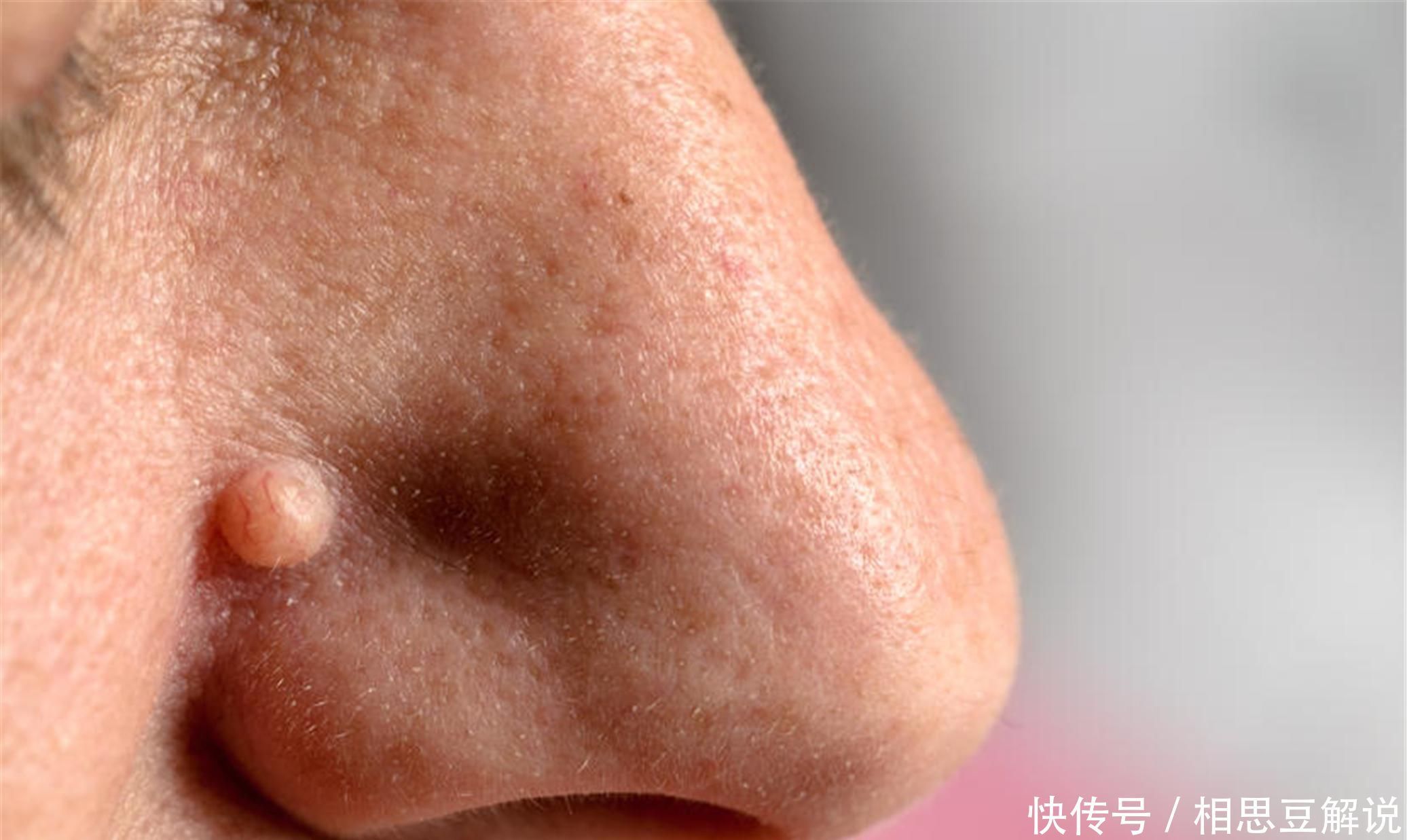 實用|脾胃不和百病生4個調理脾胃小方法,簡單實用,值得收藏