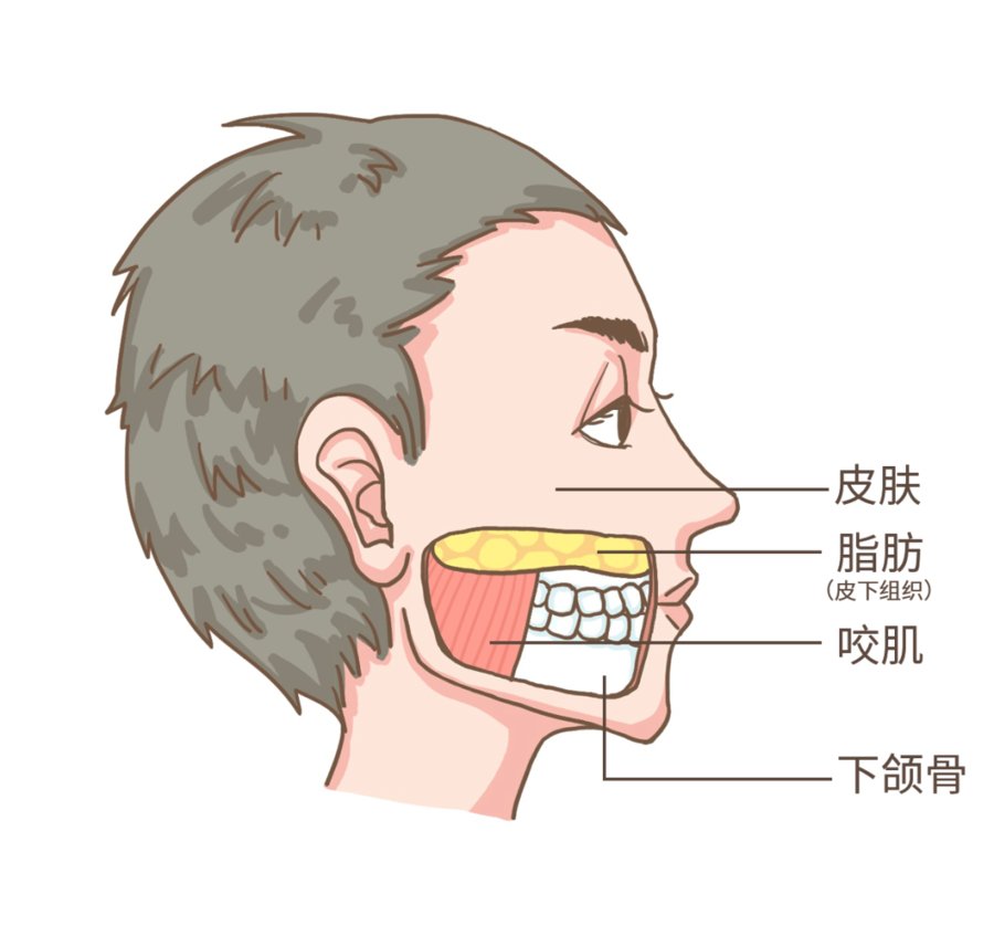 发腮|济南海峡整形分享：发腮了怎么办？