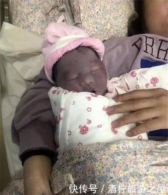 惊喜|刚出生的女儿好像蓝莓成精,妈妈看后直接哭了,3个月后收获惊喜