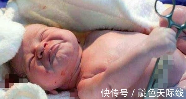 脐带|宝宝刚刚生下,医生要剪脐带时,宝宝的动作,让医生出了一身冷汗