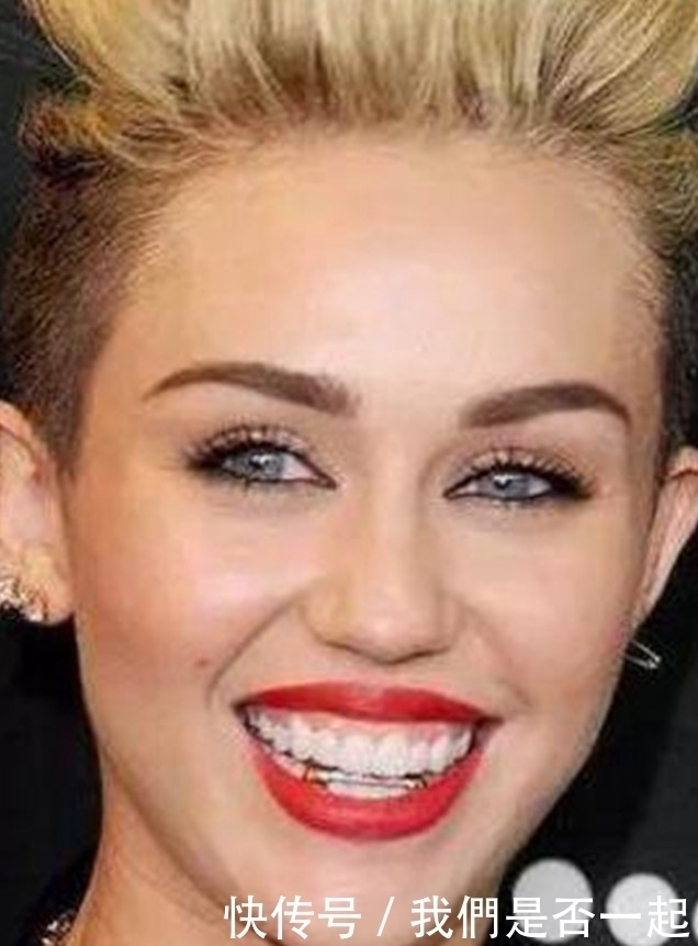 钻石|土豪的世界我们果然不懂，牙齿上面镶钻，你能接受吗？