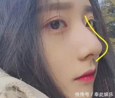 草莓鼻|女生想拥有“婴儿鼻”，起床后坚持这3个习惯，或助你远离“草莓鼻”