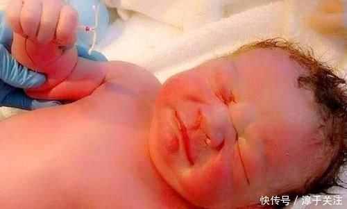 孩子|助产大夫被新生儿“碰瓷”,网友调侃这么记仇,长大后不好惹