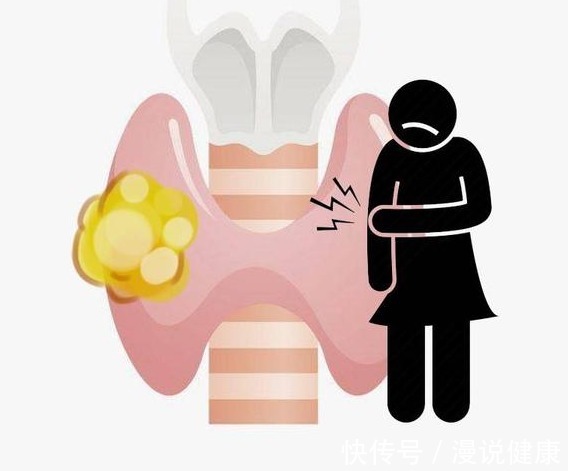 脖子|实不相瞒,长了甲状腺结节,脖子多半会有3个表现,不妨自查一下
