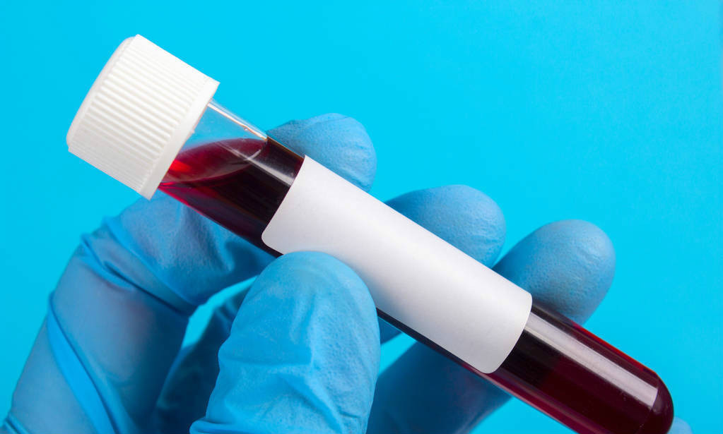 元凶|终于找到癌症的元凶了，肿瘤科医生提醒，四个部位最好每年体检