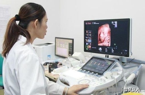 孕期|做四维彩超前,这些事项孕妈最好知道,不然浪费钱,还会伤害宝宝