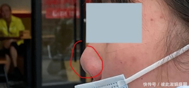 机构|女子贷款做隆鼻手术失败,医院看到塌陷鼻子后连夜改名:不是一家