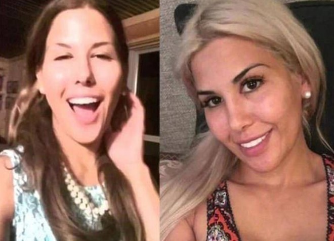 隆鼻 女子花重金整容,一年经历13次整容手术,整容前后判若两人