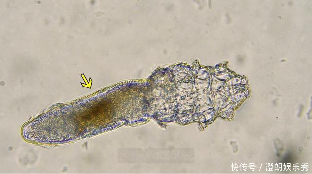 除螨|你可能已被“寄生虫”包围,有的在你脸上打洞,还有的住在毛囊里